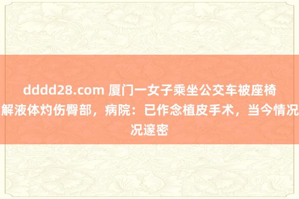 dddd28.com 厦门一女子乘坐公交车被座椅上不解液体灼伤臀部，病院：已作念植皮手术，当今情况邃密